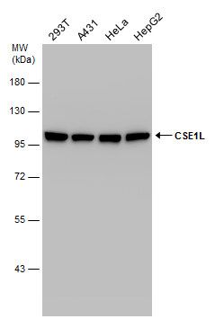 CSE1L Rabbit Polyclonal Antibody