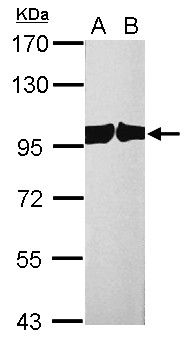 CSE1L Rabbit Polyclonal Antibody