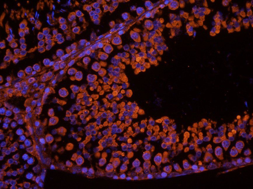 CSEN Rabbit Polyclonal Antibody