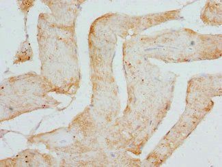 CSRP3 Antibody
