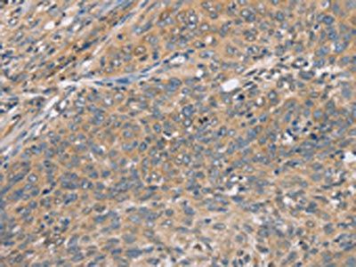 CST2 Antibody
