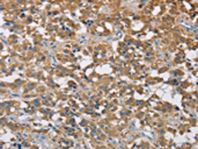 CST2 Antibody