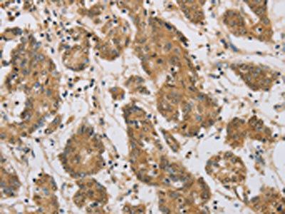 CST6 Antibody