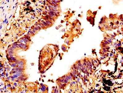 CSTA Antibody