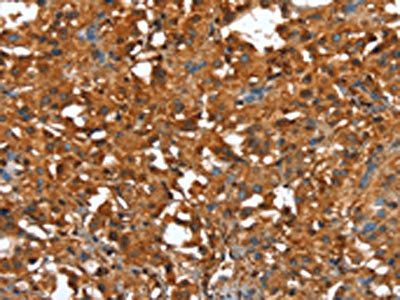 CTBP1 Antibody
