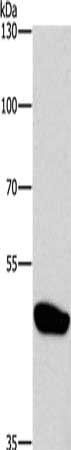 CTBP1 Antibody