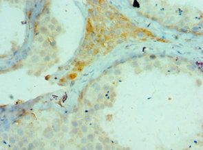 CTCFL Antibody