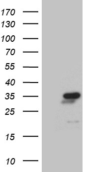CTDSP2 Antibody