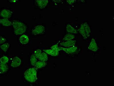 CTH Antibody