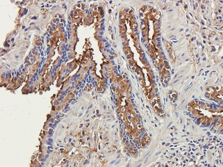 CTLA4 Rabbit Polyclonal Antibody