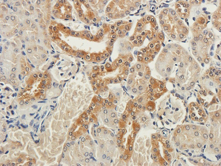 CTLA4 Rabbit Polyclonal Antibody