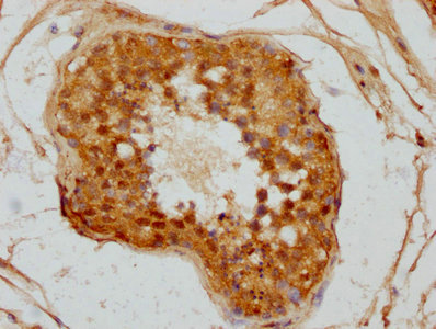 CTNNA3 Antibody