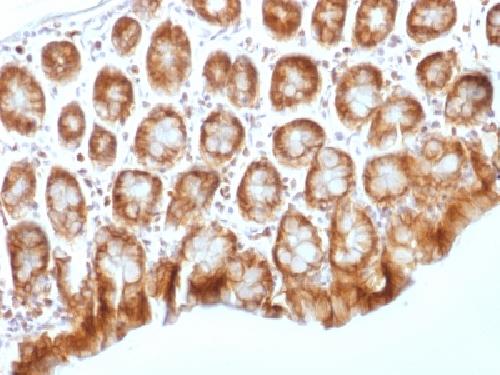 CTNNB1 Antibody