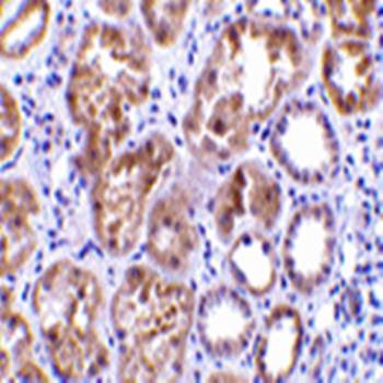 CTRP1 Rabbit Polyclonal Antibody