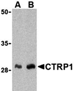 CTRP1 Rabbit Polyclonal Antibody