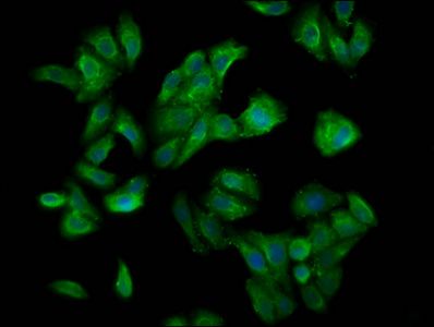 CUL7 Antibody