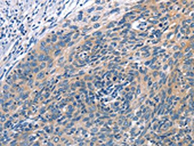 CUL7 Antibody