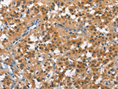 CUL7 Antibody