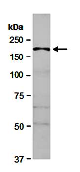 CUL7 (C) Antibody, Rabbit Polyclonal