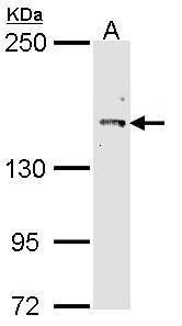 Cullin 7 Rabbit Polyclonal Antibody
