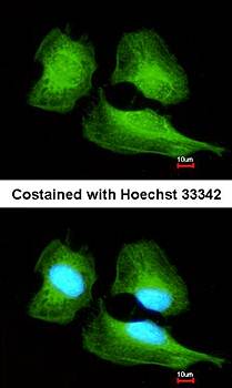 Cullin-7 Rabbit Polyclonal Antibody