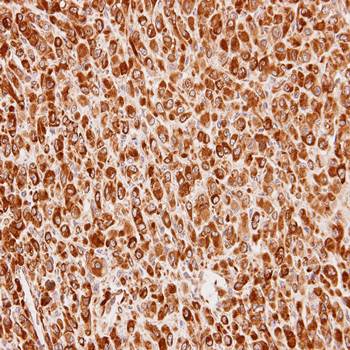 Cullin-7 Rabbit Polyclonal Antibody
