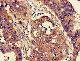 CUTA Antibody