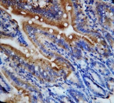 Fractalkine CX3CL1 Rabbit Polyclonal Antibody