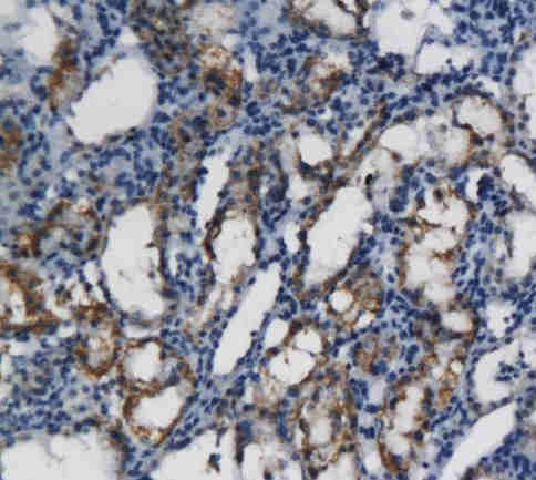 CXCL11 Rabbit Polyclonal Antibody
