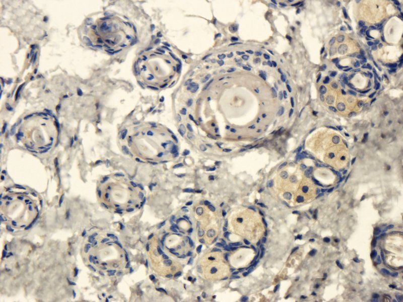 CXCL11 Rabbit Polyclonal Antibody