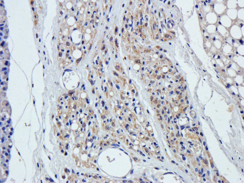CXCL13 Rabbit Polyclonal Antibody
