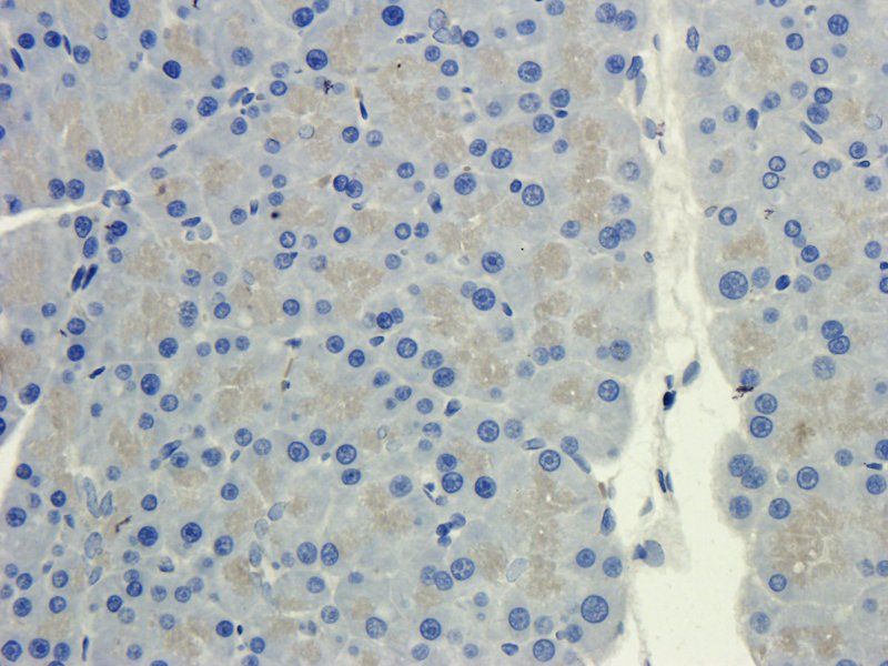 CXCL14 Rabbit Polyclonal Antibody