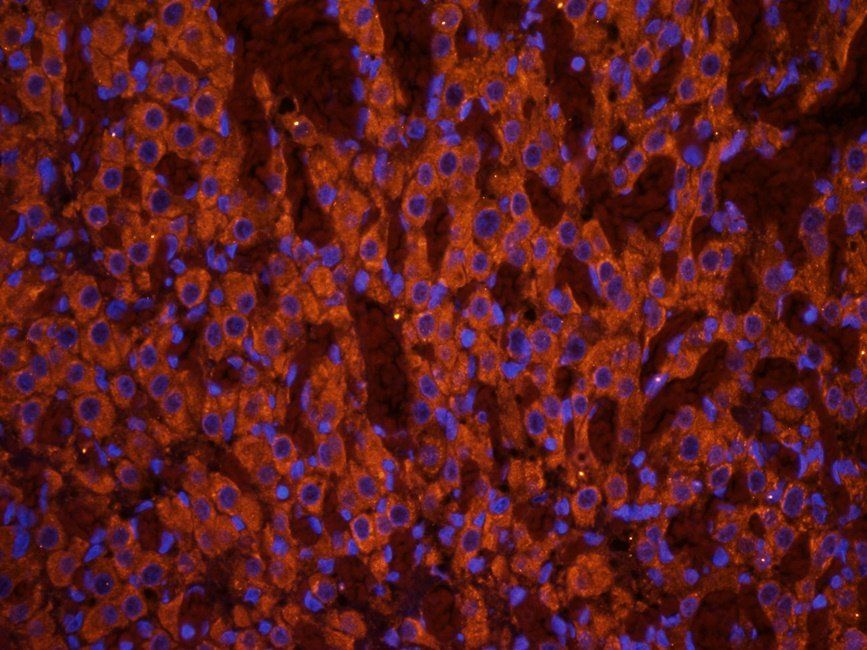 CXCL5 Rabbit Polyclonal Antibody