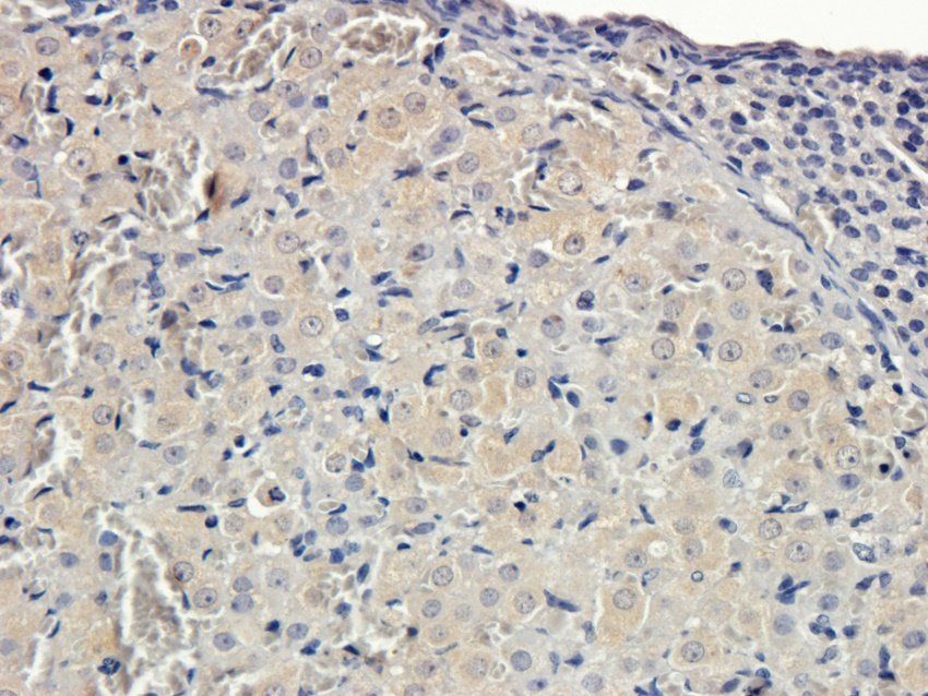 CXCL5 Rabbit Polyclonal Antibody