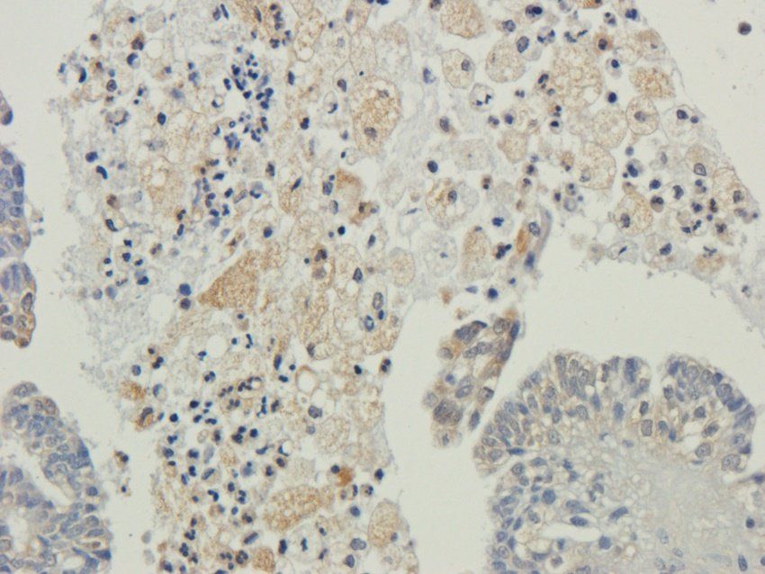 CXCL5 Rabbit Polyclonal Antibody