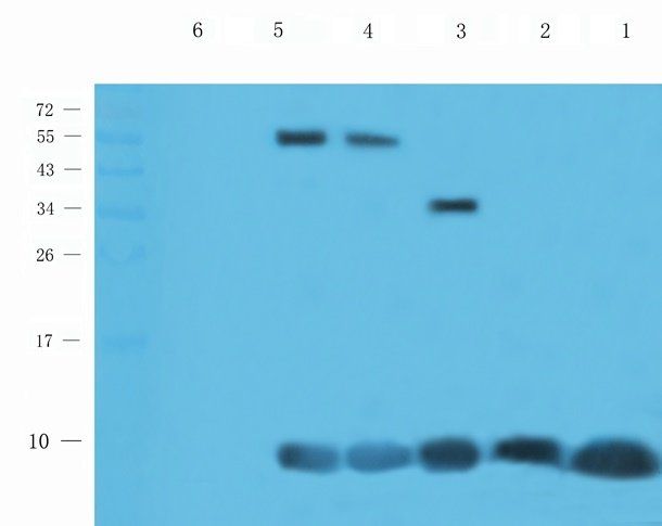 CXCL5 Rabbit Polyclonal Antibody