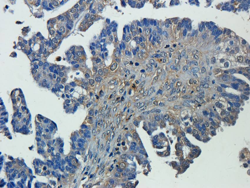 CXCL5 Rabbit Polyclonal Antibody