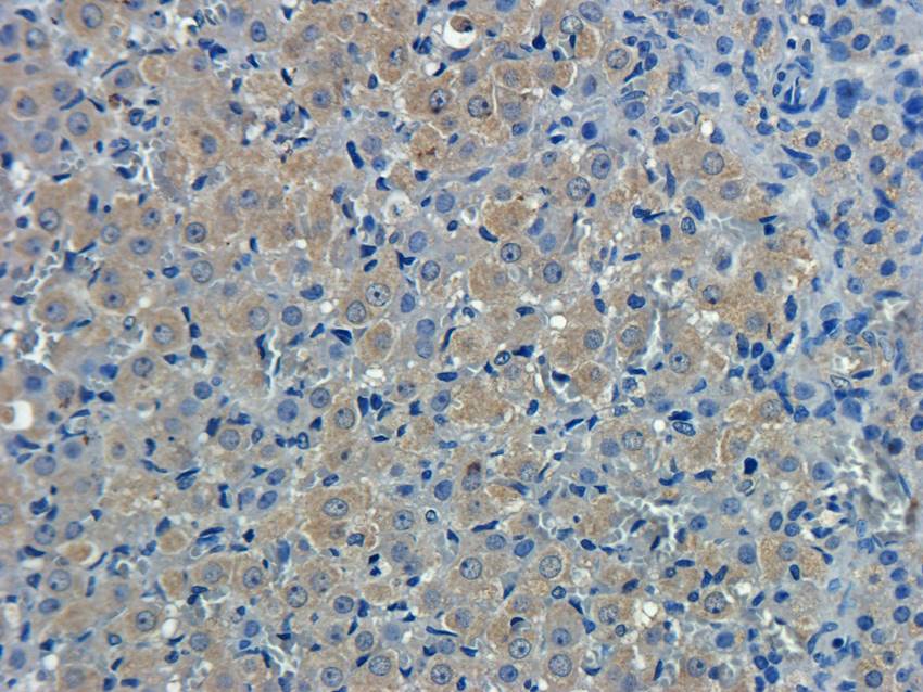 CXCL5 Rabbit Polyclonal Antibody