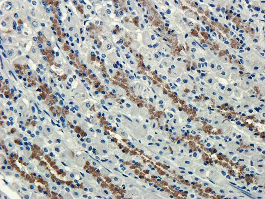 CXCL5 Rabbit Polyclonal Antibody
