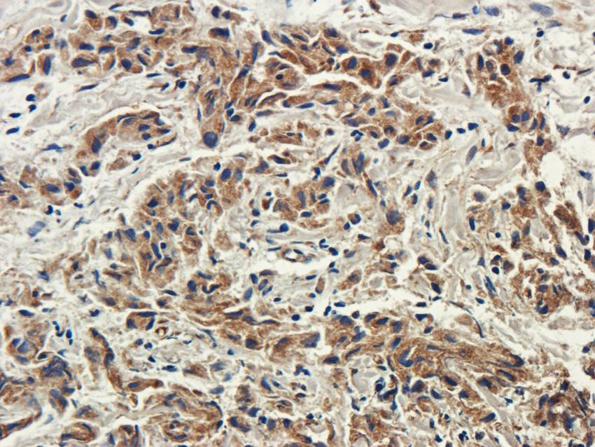 CXCL5 Rabbit Polyclonal Antibody