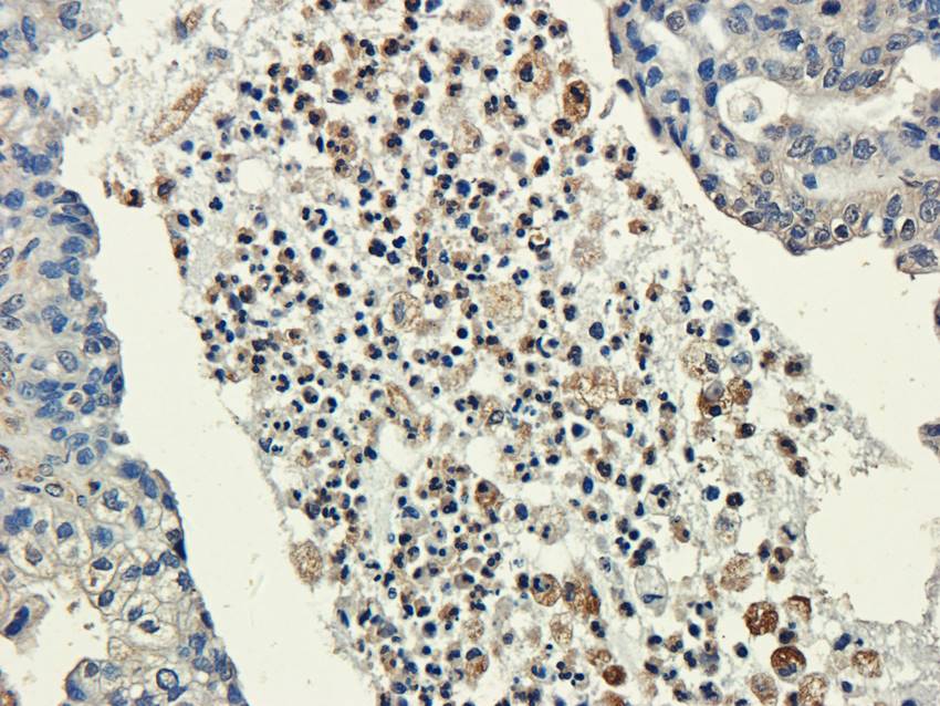 CXCL5 Rabbit Polyclonal Antibody