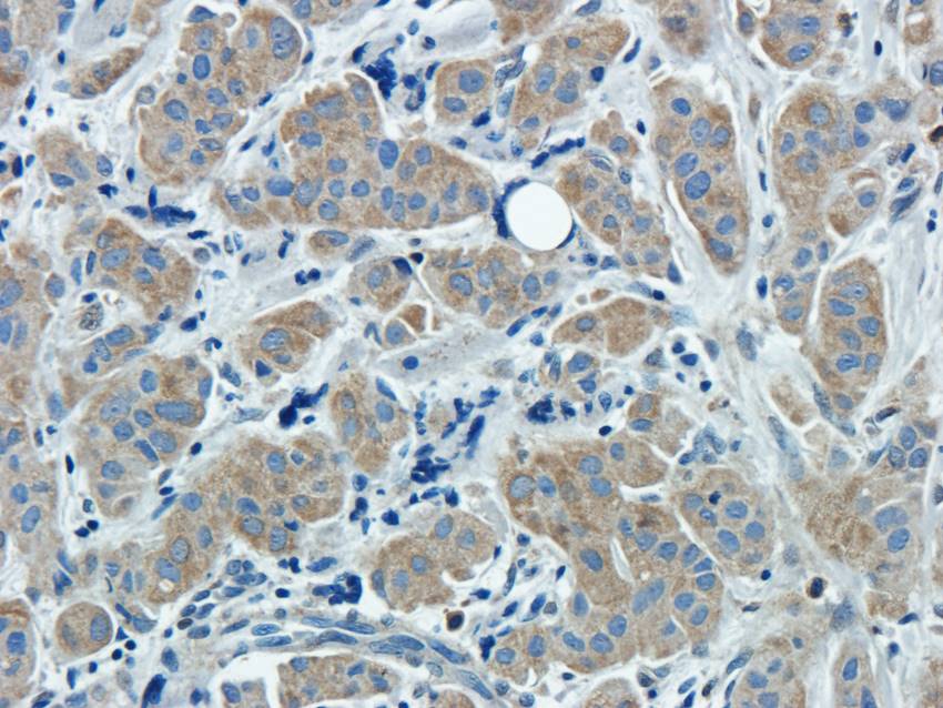 CXCL5 Rabbit Polyclonal Antibody