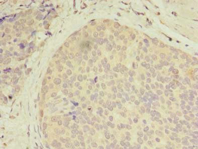 CXCL6 Antibody