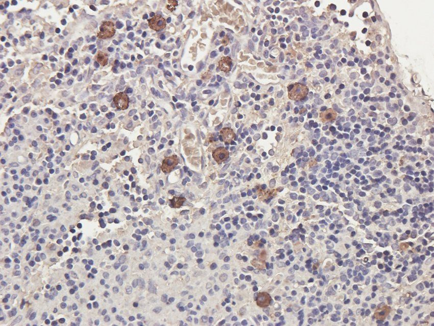 CXCR1 Rabbit Polyclonal Antibody