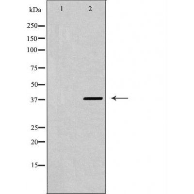 CXCR4 Antibody