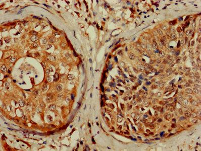 CDKN1A Antibody