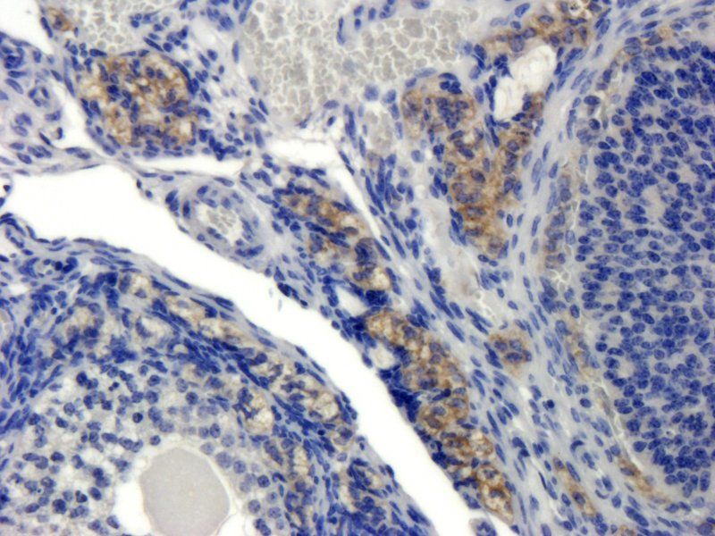 CYP11A1 Rabbit Polyclonal Antibody