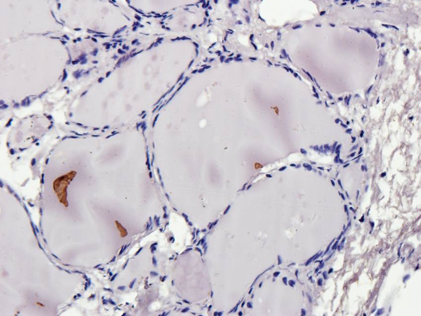 CYP11B1 Rabbit Polyclonal Antibody