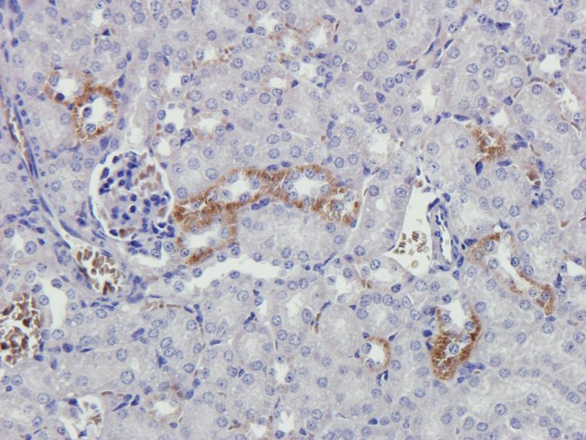 CYP11B1 Rabbit Polyclonal Antibody