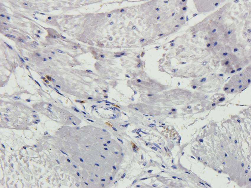 CYP11B1 Rabbit Polyclonal Antibody